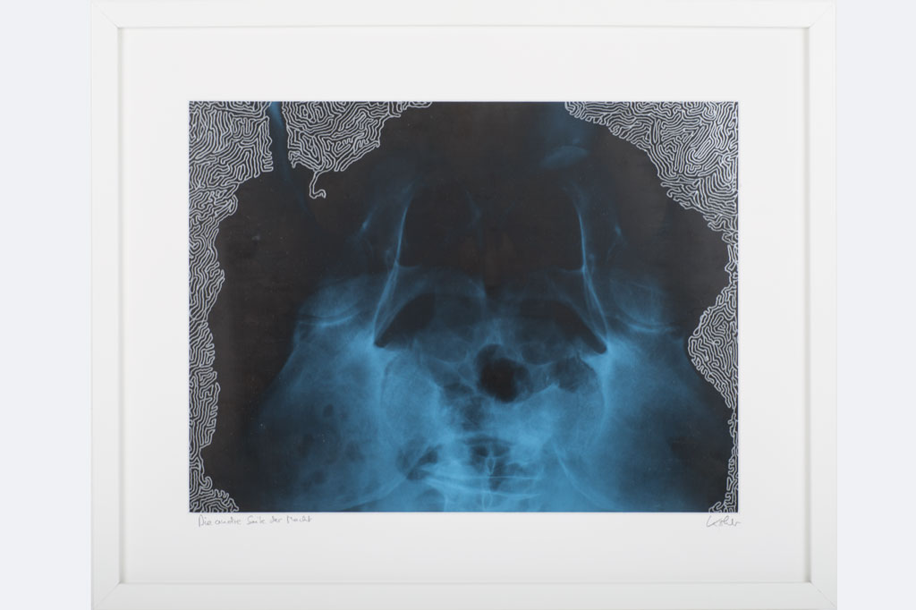 Reinhard Köhler, „Die andre Seite der Macht“ Silberlackstift auf Röntgenaufnahme 42 x 52 cm, gerahmt