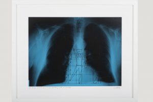 „Im Übrigen ist auch eine lässige Sitzhaltung nicht zu verwerfen“, Reinhard Köhler, Röntgenaufnahme, Folienstiftzeichnung, 42x52 cm